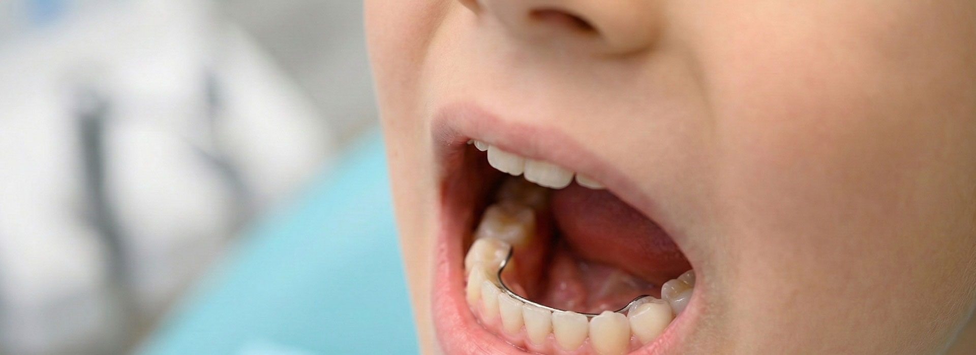 Kieferorthopädie von Anfang an