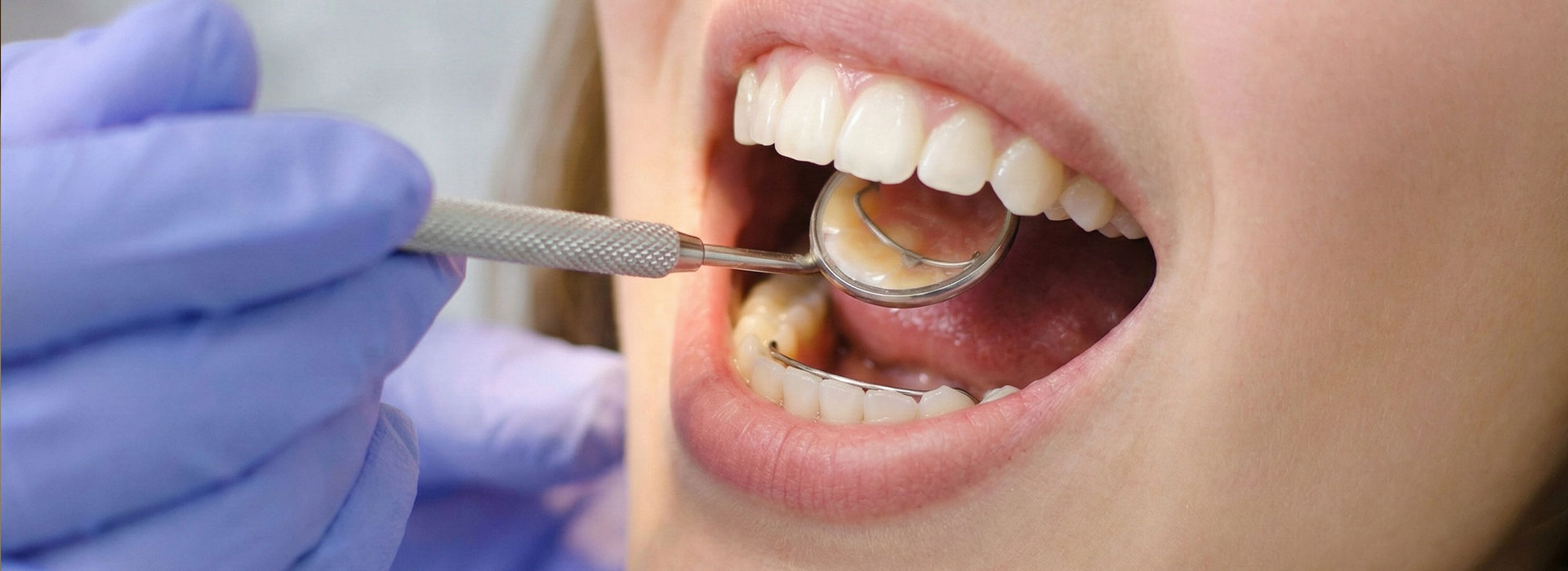 Kieferorthop&auml;die f&uuml;r Jugendliche