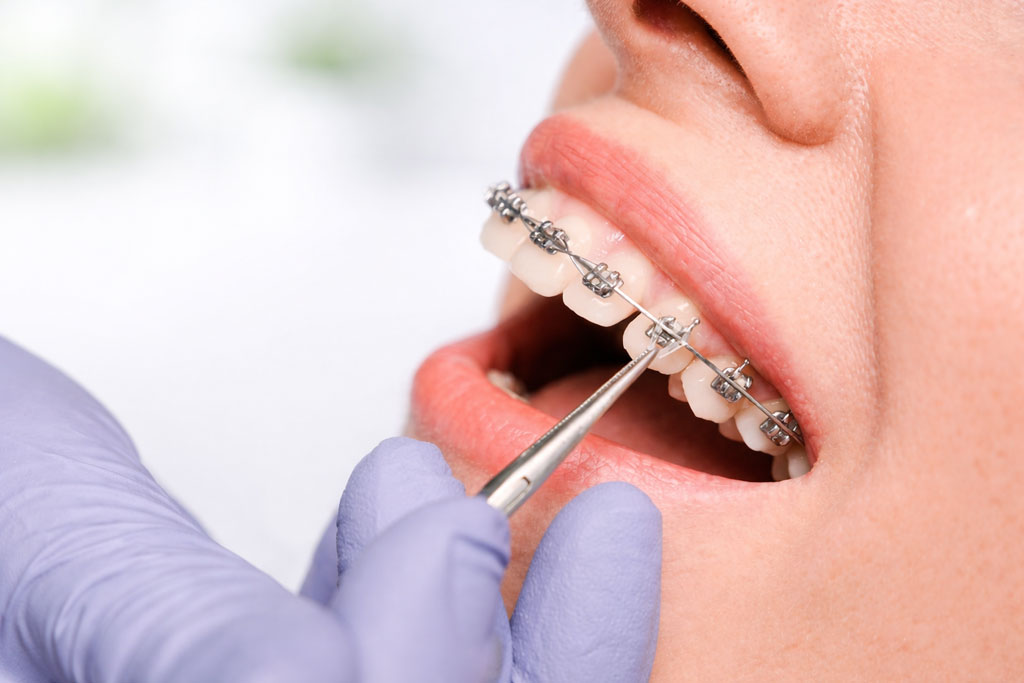 Therapie bei Erwachsenen 